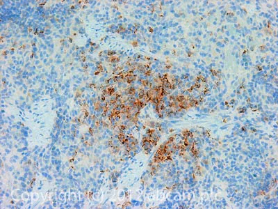 Immunohistochemistry (Formalin/PFA-fixed paraffin-embedded sections) - Anti-MHC Class II antibody [MRC OX-6] - BSA and Azide free (AB237959)
