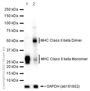 Western blot - Anti-MHC Class II beta antibody [EPR11227] (AB170867)