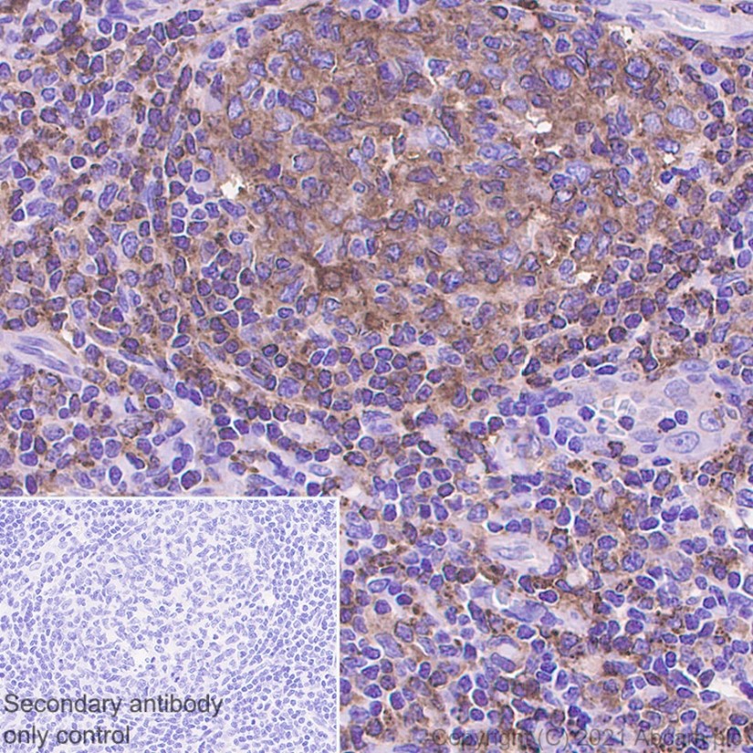 Immunohistochemistry (Formalin/PFA-fixed paraffin-embedded sections) - Anti-MHC Class II beta antibody [EPR11227] - BSA and Azide free (AB249550), expandable thumbnail