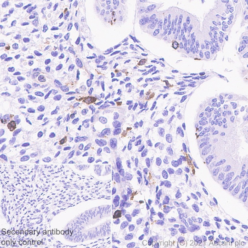 Immunohistochemistry (Formalin/PFA-fixed paraffin-embedded sections) - Anti-MHC Class II beta antibody [EPR11227] - BSA and Azide free (AB249550), expandable thumbnail