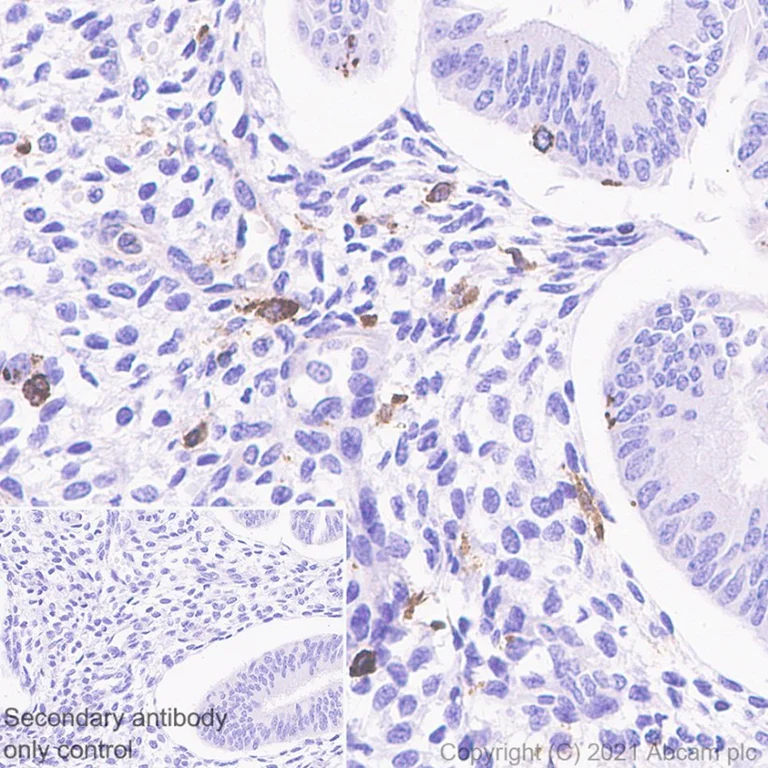 Immunohistochemistry (Formalin/PFA-fixed paraffin-embedded sections) - Anti-MHC Class II beta antibody [EPR11227] - BSA and Azide free (AB249550)