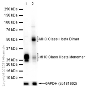Western blot - Anti-MHC Class II beta antibody [EPR11227] - BSA and Azide free (AB249550), expandable thumbnail