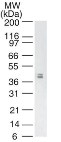 Western blot - Anti-MHC Qa1b antibody [6A8.6F10.1A6] (AB72487)