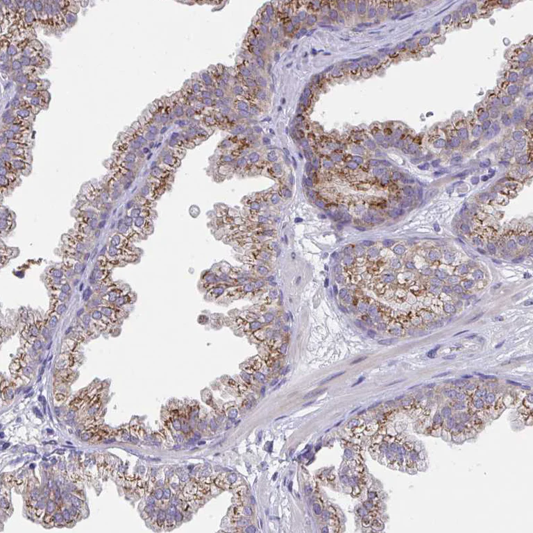 Immunohistochemistry (Formalin/PFA-fixed paraffin-embedded sections) - Anti-MIA3/TANGO1 antibody (AB244506)