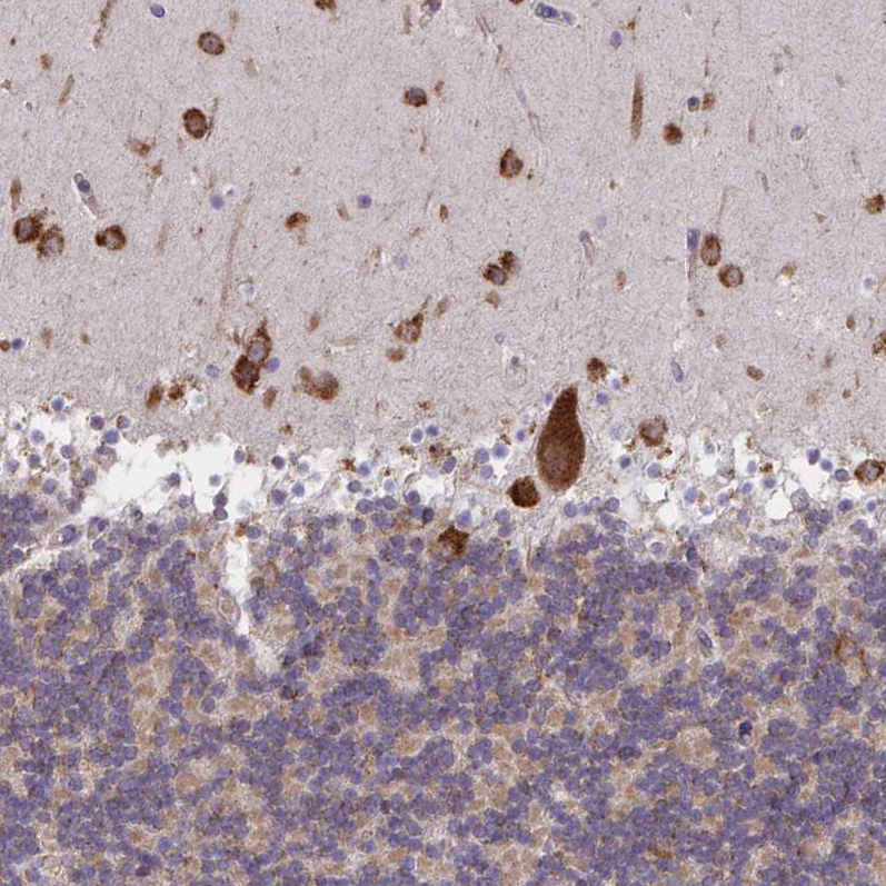 Immunohistochemistry (Formalin/PFA-fixed paraffin-embedded sections) - Anti-MIA3/TANGO1 antibody (AB244506), expandable thumbnail