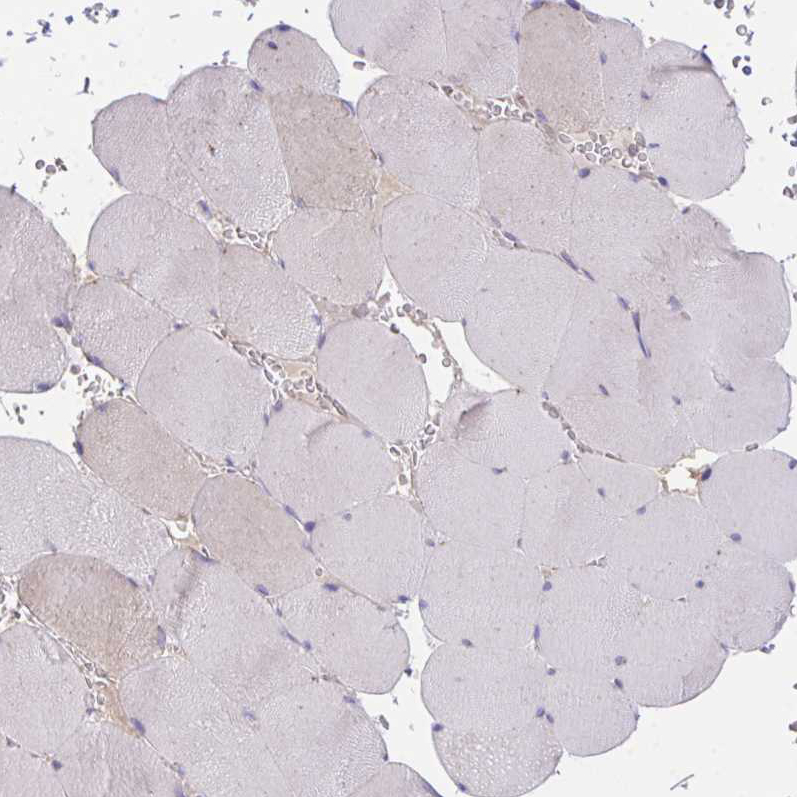 Immunohistochemistry (Formalin/PFA-fixed paraffin-embedded sections) - Anti-MIA3/TANGO1 antibody (ab244506), expandable thumbnail