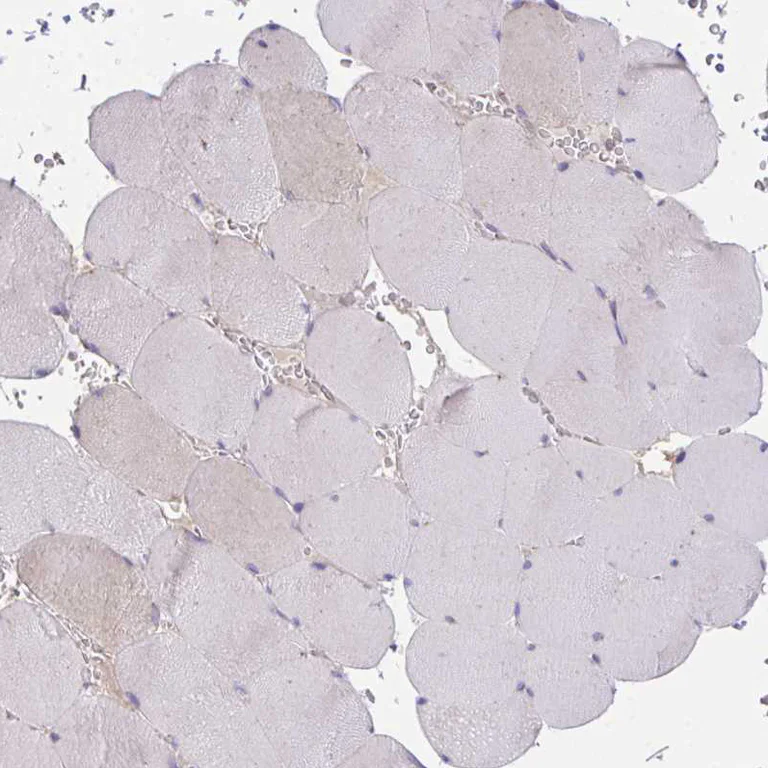 Immunohistochemistry (Formalin/PFA-fixed paraffin-embedded sections) - Anti-MIA3/TANGO1 antibody (AB244506)