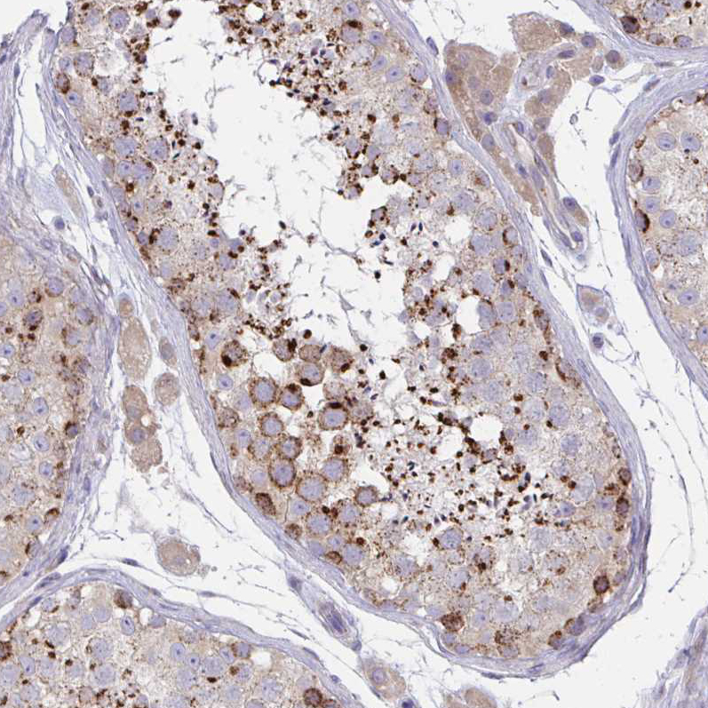 Immunohistochemistry (Formalin/PFA-fixed paraffin-embedded sections) - Anti-MIA3/TANGO1 antibody (AB244506), expandable thumbnail