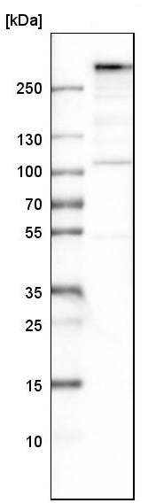 Western blot - Anti-MIA3/TANGO1 antibody (AB244506), expandable thumbnail