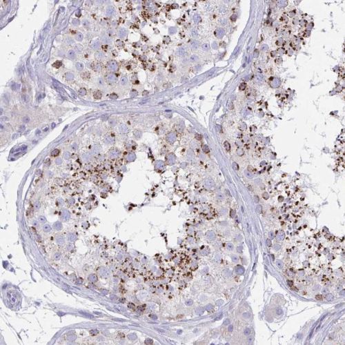 Immunohistochemistry (Formalin/PFA-fixed paraffin-embedded sections) - Anti-MIA3/TANGO1 antibody (AB244511)