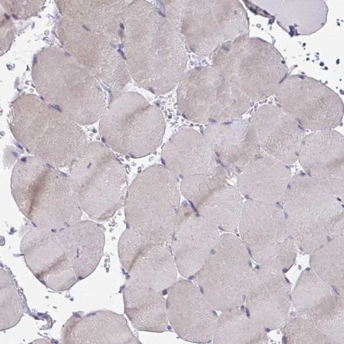 Immunohistochemistry (Formalin/PFA-fixed paraffin-embedded sections) - Anti-MIA3/TANGO1 antibody (AB244511)
