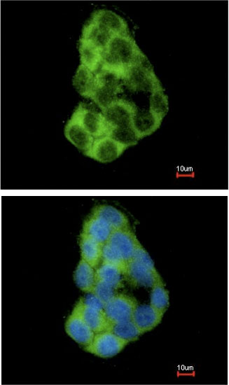 Immunocytochemistry/ Immunofluorescence - Anti-MIA3/TANGO1 antibody (AB97881), expandable thumbnail