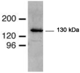 Western blot - Anti-Mib1/Mindbomb antibody (AB74134), expandable thumbnail