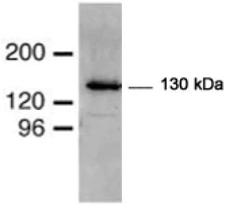 Western blot - Anti-Mib1/Mindbomb antibody (AB74134)