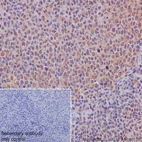 Immunohistochemistry (Formalin/PFA-fixed paraffin-embedded sections) - Anti-Mib1/Mindbomb antibody [EPR2762(2)] (AB124929), expandable thumbnail