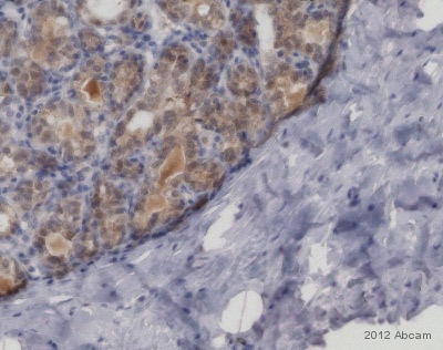 Immunohistochemistry (Formalin/PFA-fixed paraffin-embedded sections) - Anti-Mib1/Mindbomb antibody [EPR2762(2)] (AB124929), expandable thumbnail