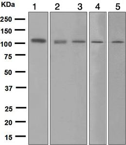 Western blot - Anti-Mib1/Mindbomb antibody [EPR2762(2)] (ab124929), expandable thumbnail