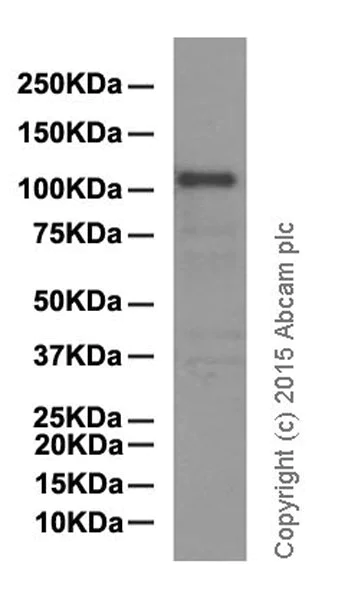 Western blot - Anti-Mib1/Mindbomb antibody [EPR2762(2)] (AB124929)