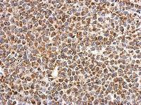 Immunohistochemistry (Formalin/PFA-fixed paraffin-embedded sections) - Anti-MIC19 antibody (AB154500)