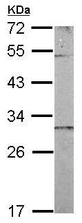 Western blot - Anti-MIC19 antibody (AB154500)