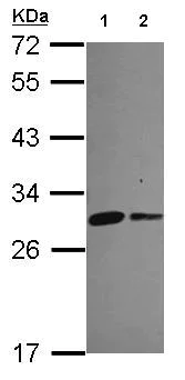 Western blot - Anti-MIC19 antibody (AB154500)