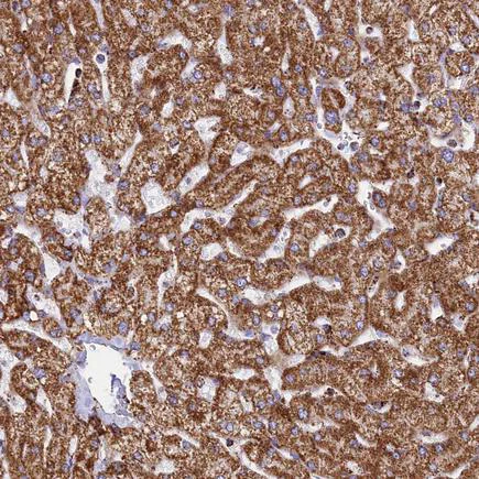 Immunohistochemistry (Formalin/PFA-fixed paraffin-embedded sections) - Anti-MIC19 antibody (AB224565)