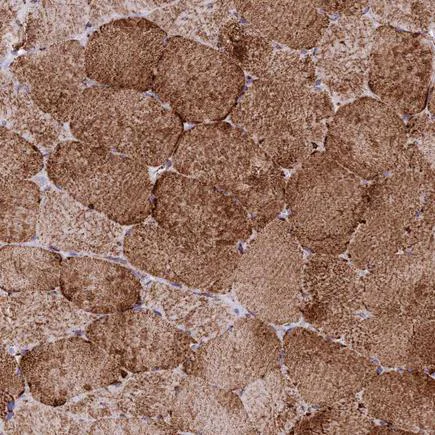 Immunohistochemistry (Formalin/PFA-fixed paraffin-embedded sections) - Anti-MIC19 antibody (AB224565)