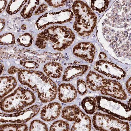 Immunohistochemistry (Formalin/PFA-fixed paraffin-embedded sections) - Anti-MIC19 antibody (AB224565)