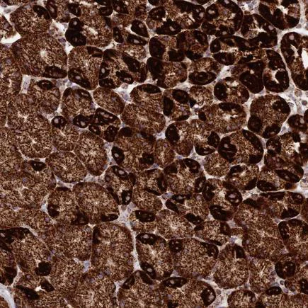 Immunohistochemistry (Formalin/PFA-fixed paraffin-embedded sections) - Anti-MIC19 antibody (AB224565)