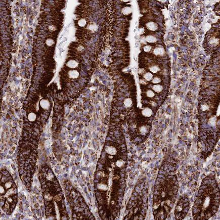 Immunohistochemistry (Formalin/PFA-fixed paraffin-embedded sections) - Anti-MIC19 antibody (AB224565)