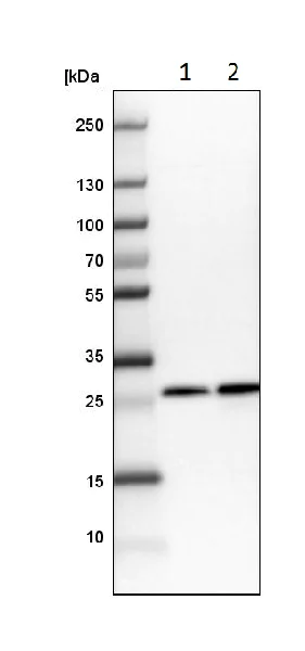 Western blot - Anti-MIC19 antibody (AB224565)