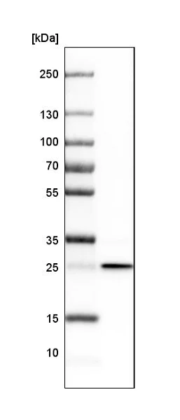 Western blot - Anti-MIC19 antibody (AB224565)
