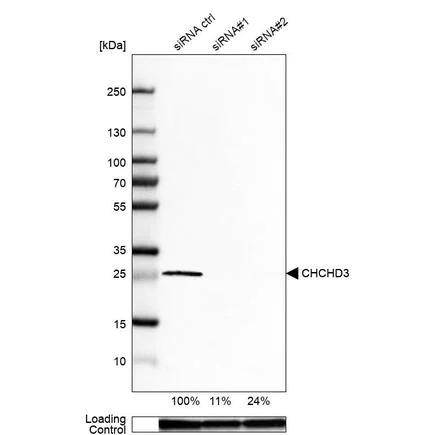 Western blot - Anti-MIC19 antibody (AB224565)