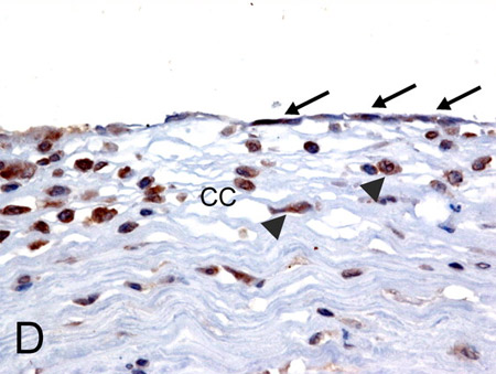 Immunohistochemistry (Formalin/PFA-fixed paraffin-embedded sections) - Anti-MICA antibody (AB62540)