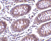 Immunohistochemistry (Formalin/PFA-fixed paraffin-embedded sections) - Anti-MICA antibody (AB62540)