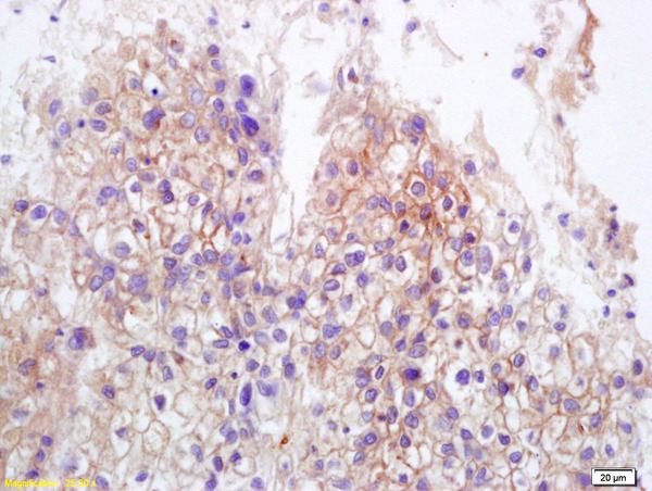Immunohistochemistry (Formalin/PFA-fixed paraffin-embedded sections) - Anti-MICA + MICB antibody (AB203679)