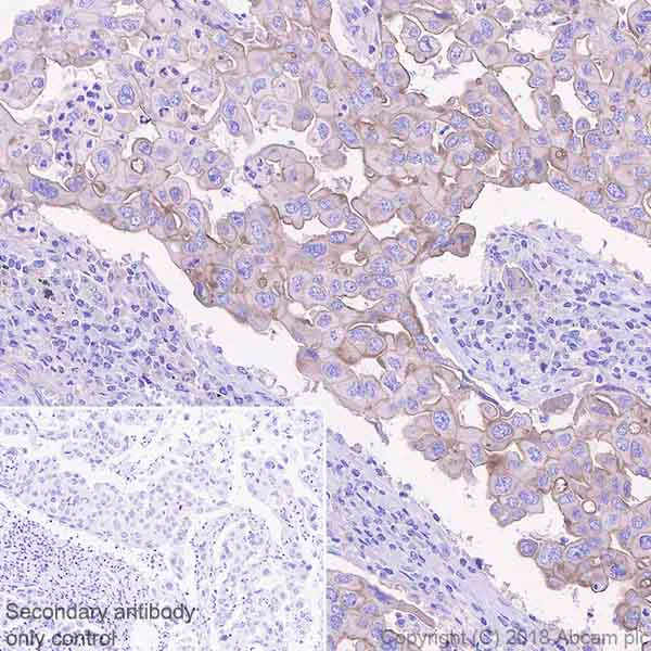 Immunohistochemistry (Formalin/PFA-fixed paraffin-embedded sections) - Anti-MICA + MICB antibody [EPR22031] (AB224702)