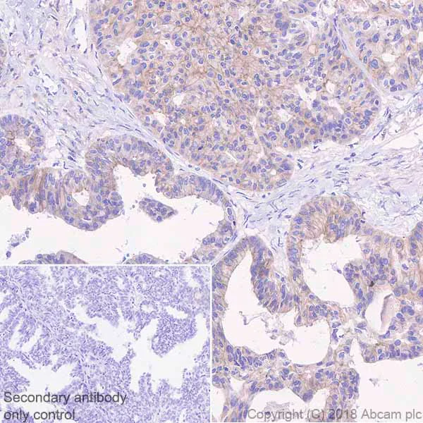 Immunohistochemistry (Formalin/PFA-fixed paraffin-embedded sections) - Anti-MICA + MICB antibody [EPR22031] (AB224702)