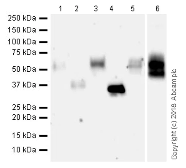 Western blot - Anti-MICA + MICB antibody [EPR22031] (AB224702)