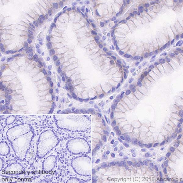 Immunohistochemistry (Formalin/PFA-fixed paraffin-embedded sections) - Anti-MICA + MICB antibody [EPR22031] - BSA and Azide free (AB241513)