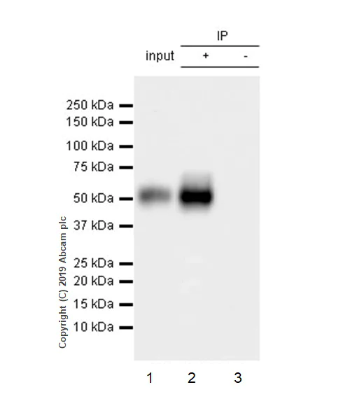 Immunoprecipitation - Anti-MICA + MICB antibody [EPR22071-91] - BSA and Azide free (AB254196)