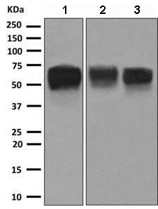 Western blot - Anti-MICA + MICB antibody [EPR6568] (AB150355), expandable thumbnail