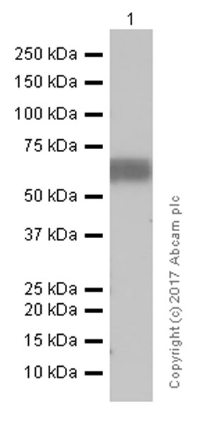 Western blot - Anti-MICA + MICB antibody [EPR6568] (AB150355), expandable thumbnail