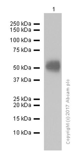 Western blot - Anti-MICA + MICB antibody [EPR6568] (AB150355), expandable thumbnail