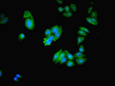 Immunocytochemistry/ Immunofluorescence - Anti-MICAL2 antibody (AB238901)