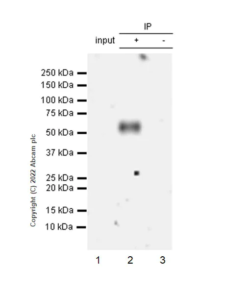 Immunoprecipitation - Anti-MICB antibody [EPR26362-65] - BSA and Azide free (AB300486)