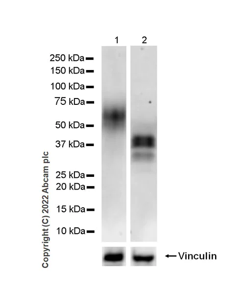 Western blot - Anti-MICB antibody [EPR26362-65] - BSA and Azide free (AB300486)