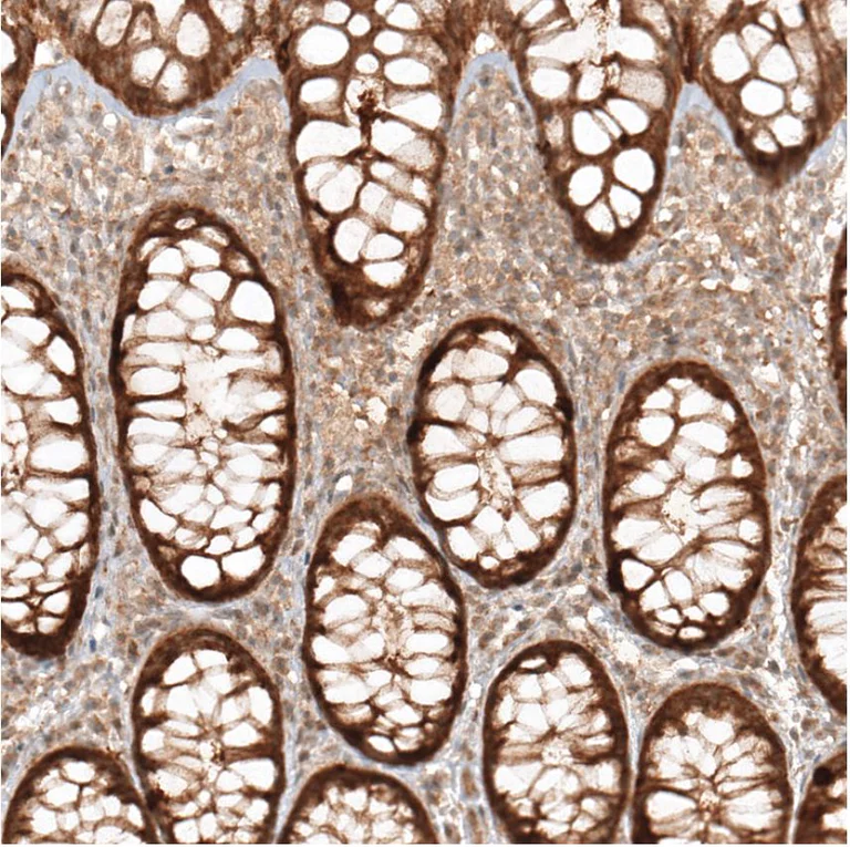 Immunohistochemistry (Formalin/PFA-fixed paraffin-embedded sections) - Anti-MICU1 antibody (AB224161)