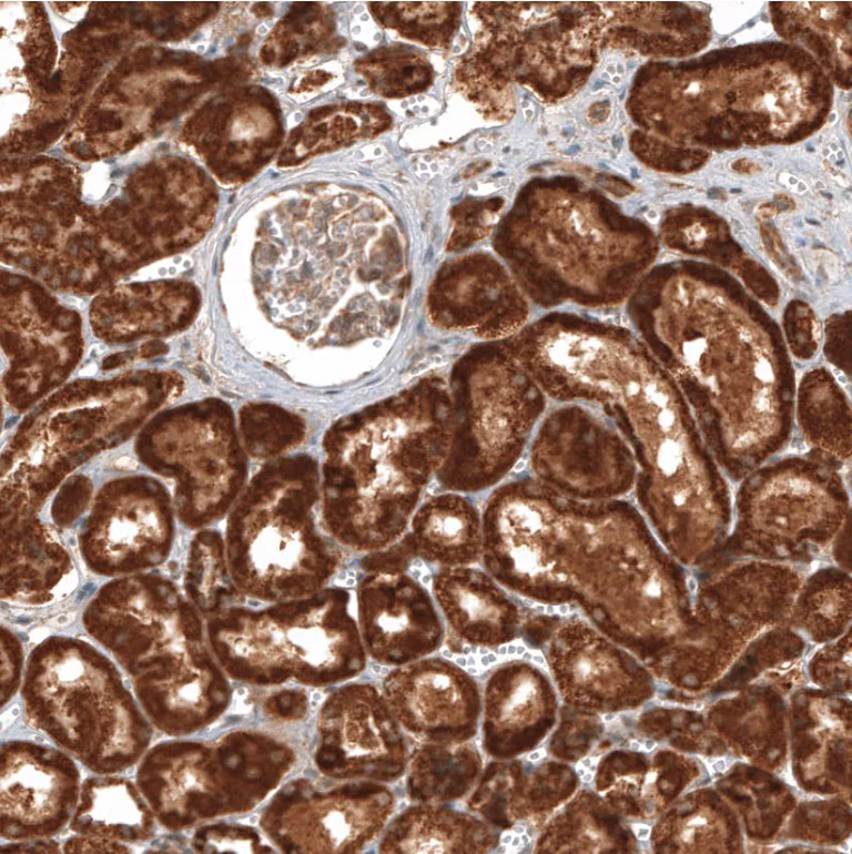 Immunohistochemistry (Formalin/PFA-fixed paraffin-embedded sections) - Anti-MICU1 antibody (AB224161)