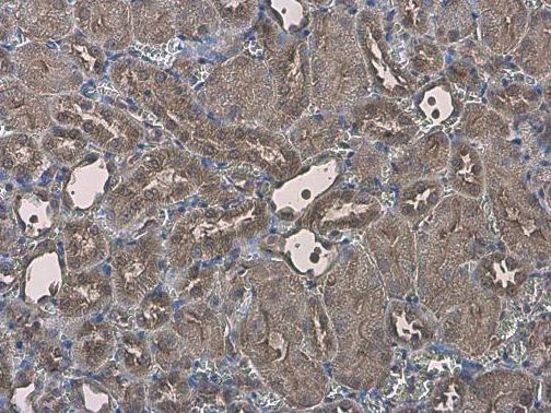 Immunohistochemistry (Formalin/PFA-fixed paraffin-embedded sections) - Anti-MICU2 antibody (AB101465), expandable thumbnail